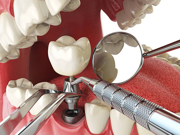 Best Broken Tooth Emergency  in Tallmadge, OH
